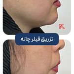 کلینیک زیبایی و جوانسازی پوست و مو الین