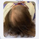 اولین مرکز میکرواسکالپ مشهد تاپ اسکالپ