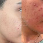 Nasim_skin_house