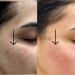 کلینیک زیبایی بلا