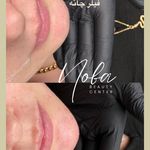 کلینیک زیبایی و لیزر مو زائد نوبا