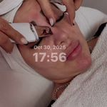 ریموو علمی تتو با اصول پزشکی مارال