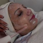 ریموو علمی تتو با اصول پزشکی مارال