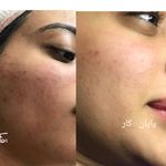 فیشیال و لیفت پوست اسلامشهر