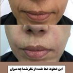 مطب زیبایی خانم محمدرضایی پوست ومو