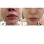 پاکسازی پوست و مو مهسام