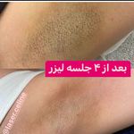 مرکز زیبایی وخدمات لیزر و فیشیال تراپی