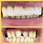 مرکز دندانپزشکی و دندانسازی اشراق