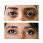 بلفاروپلاستی دکتر سیدمحمدرضا حسینی