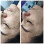 مرکز تخصصی فیشیال و مراقبت ازپوستsb,skin