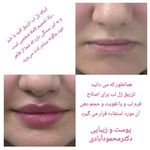 مركز ليزر و مطب زيبايی  دكتر محمودآبادی