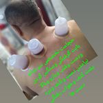حجامت تخصصی کل بدن اکبرکریمی سیار(منزل)