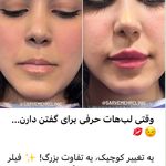 مرکز لیزر،پوست،مو و زیبایی سرو مهر