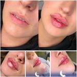 پاکسازی و فیشال تخصصی پوست جنابی،آموزش