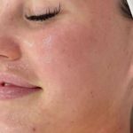 کلینیک فیشال و ماساژ سارن اسکین سارا