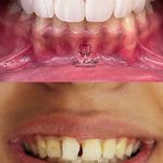 دندانپزشکی دکتر کاتبی کامپوزیت لمینیت