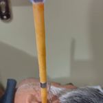خدمات طب سوزنی وطب سنتی پالیزی
