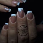 خدمات کاشت و ترمیم ناخن هدیه