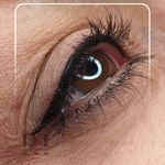 مرکز میکروبلیدینگ شیدینگ ریموو اسکالپ