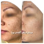 کلینیک زیبایی و لیزر مو زائد نوبا