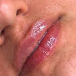 کلینیک زیبایی و مرکز لیزر و لاغری نیکشا