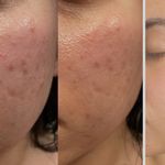 مرکزتخصصی خدمات پوست وفیشال ناهید پناهی