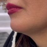 کلینیک زیبایی نومیا