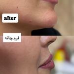 كليه خدمات زیبایی مرضیه لطفی