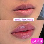 مرکز لیزر و کلینیک پوست مو زیبایی سپید