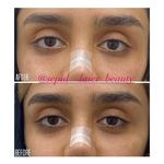 مرکز لیزر و کلینیک پوست مو زیبایی سپید