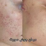 مرکز لیزر و کلینیک پوست مو زیبایی سپید