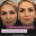 مرکز لیزر و کلینیک پوست مو زیبایی سپید