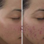 مرکز لیزر و کلینیک پوست مو زیبایی سپید