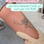 مرکز زیبایی ندا