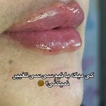 کلینیک پوست،زیبایی و لیزرماریسا