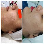 فیشال و پاکسازی شیرین نصیری درمالند