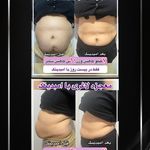 کلینیک لیزر و زیبایی مهسان
