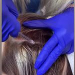 کلینیک پوست و مو و لیزر نیلوفر آبی