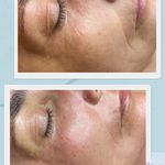 کلینیک پاکسازی پوست و فیشال ژیوان