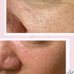 کلینیک پاکسازی پوست و فیشال ژیوان