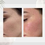 کلینیک پاکسازی پوست و فیشال ژیوان