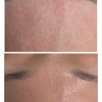 کلینیک پاکسازی پوست و فیشال ژیوان