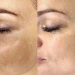 کلینیک پاکسازی پوست و فیشال ژیوان