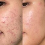 کلینیک پاکسازی پوست و فیشال ژیوان