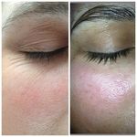 کلینیک پاکسازی پوست و فیشال ژیوان