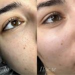 کلینیک پاکسازی پوست و فیشال ژیوان