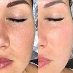 کلینیک پاکسازی پوست و فیشال ژیوان