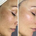 کلینیک پاکسازی پوست و فیشال ژیوان