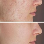 کلینیک پاکسازی پوست و فیشال ژیوان