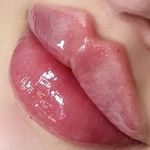 مطب پوست، مو و زیبایی و لیزر شبیرا